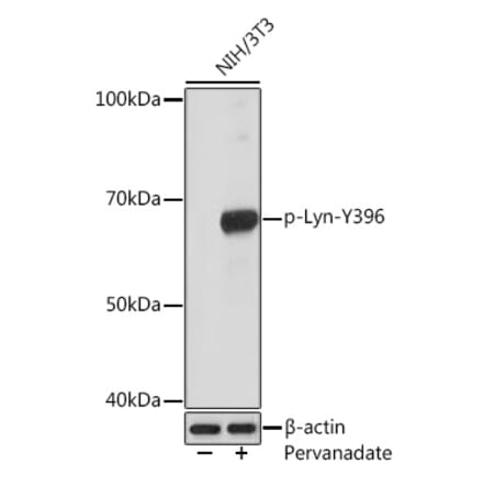 Western Blot - Anti-Lyn (phospho Tyr396) Antibody [ARC1597] (A305607) - Antibodies.com