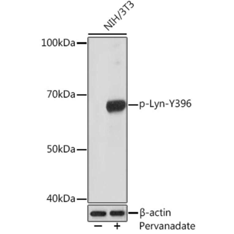 Western Blot - Anti-Lyn (phospho Tyr396) Antibody [ARC1597] (A305607) - Antibodies.com