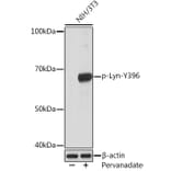 Western Blot - Anti-Lyn (phospho Tyr396) Antibody [ARC1597] (A305607) - Antibodies.com