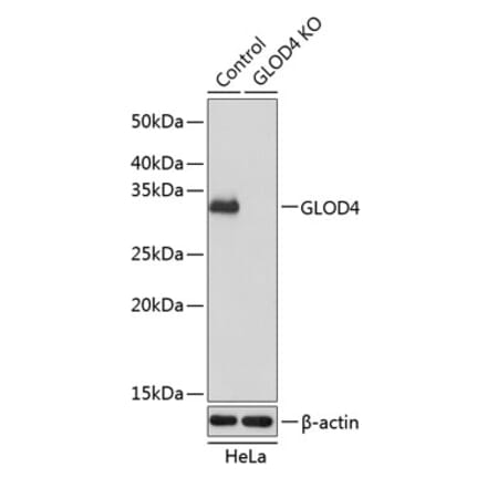 Western Blot - Anti-GLOD4 Antibody (A305608) - Antibodies.com