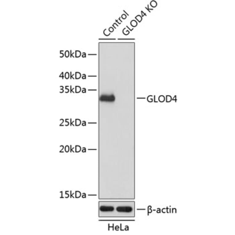 Western Blot - Anti-GLOD4 Antibody (A305608) - Antibodies.com