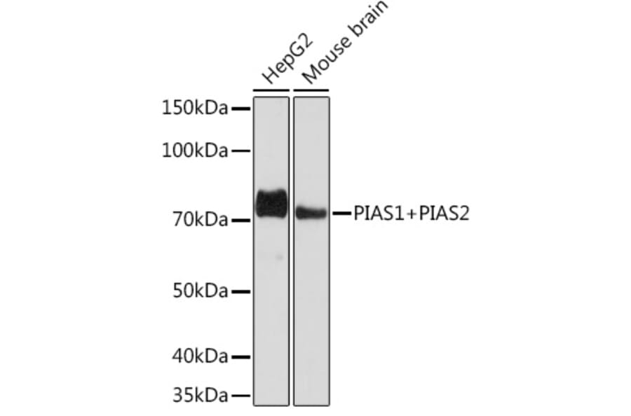 Western Blot - Anti-PIAS1 + PIAS2 Antibody [ARC1690] (A305609) - Antibodies.com