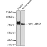Western Blot - Anti-PIAS1 + PIAS2 Antibody [ARC1690] (A305609) - Antibodies.com