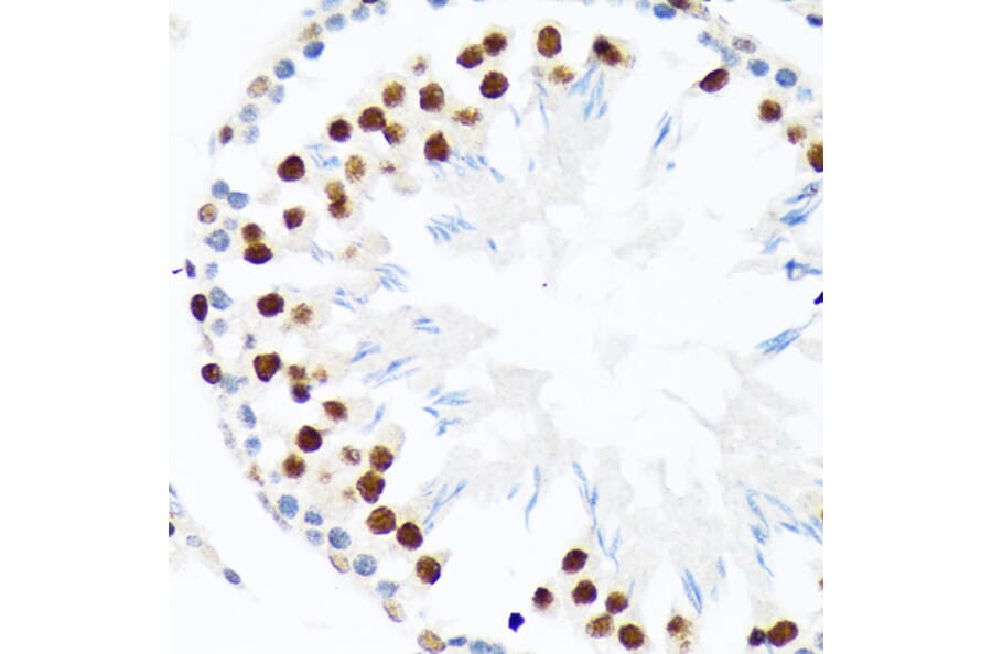 Immunohistochemistry - Anti-PIAS1 + PIAS2 Antibody [ARC1690] (A305609) - Antibodies.com