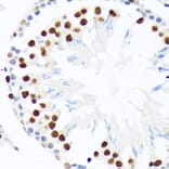 Immunohistochemistry - Anti-PIAS1 + PIAS2 Antibody [ARC1690] (A305609) - Antibodies.com