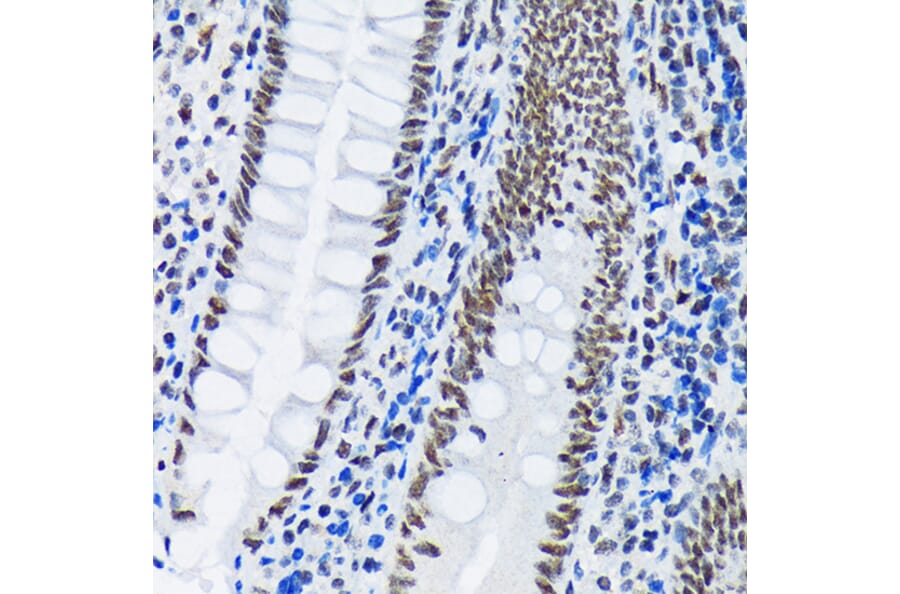Immunohistochemistry - Anti-PIAS1 + PIAS2 Antibody [ARC1690] (A305609) - Antibodies.com