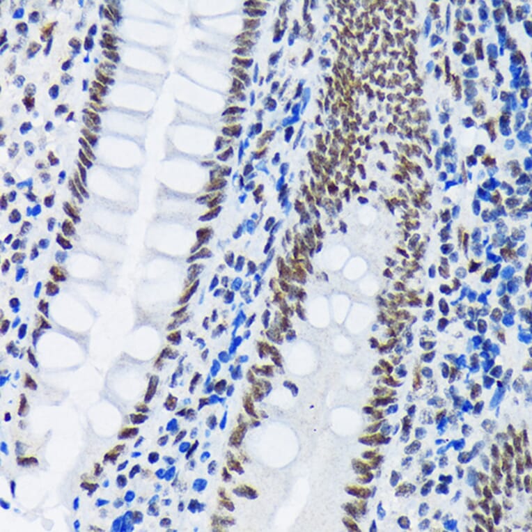 Immunohistochemistry - Anti-PIAS1 + PIAS2 Antibody [ARC1690] (A305609) - Antibodies.com