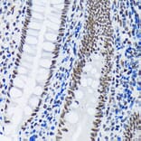 Immunohistochemistry - Anti-PIAS1 + PIAS2 Antibody [ARC1690] (A305609) - Antibodies.com