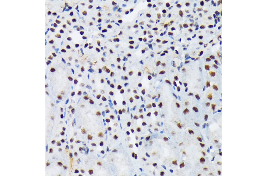 Immunohistochemistry - Anti-PIAS1 + PIAS2 Antibody [ARC1690] (A305609) - Antibodies.com
