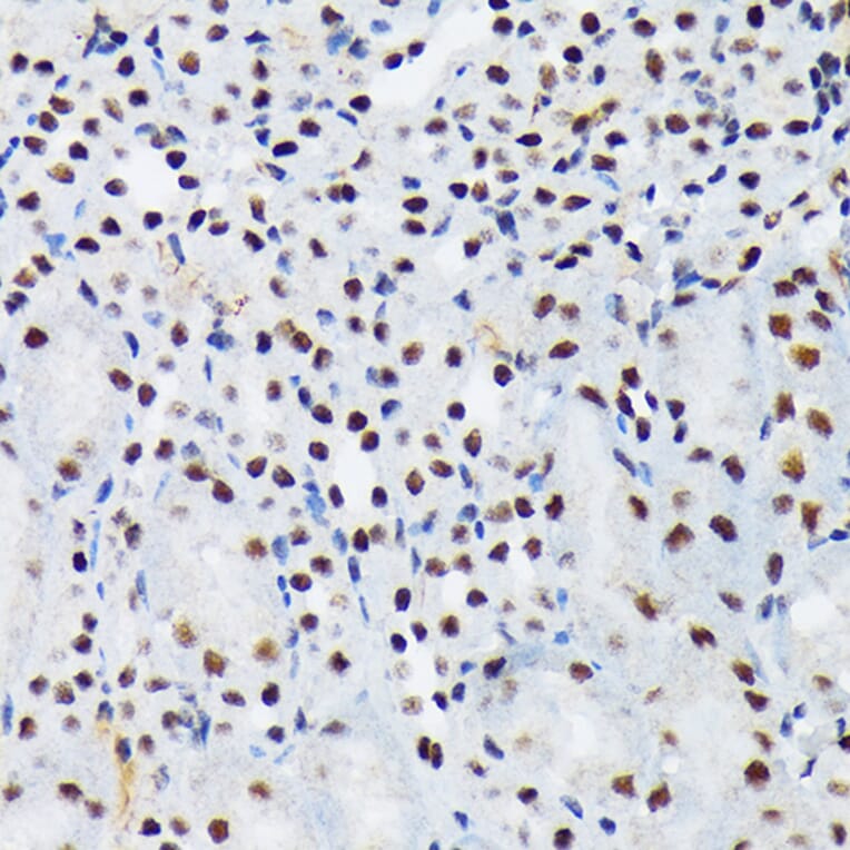 Immunohistochemistry - Anti-PIAS1 + PIAS2 Antibody [ARC1690] (A305609) - Antibodies.com