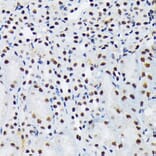 Immunohistochemistry - Anti-PIAS1 + PIAS2 Antibody [ARC1690] (A305609) - Antibodies.com