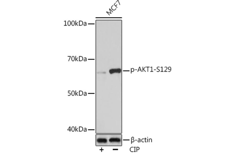 Western Blot - Anti-AKT1 (phospho Ser129) Antibody [ARC1525] (A305610) - Antibodies.com