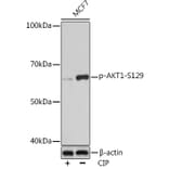 Western Blot - Anti-AKT1 (phospho Ser129) Antibody [ARC1525] (A305610) - Antibodies.com