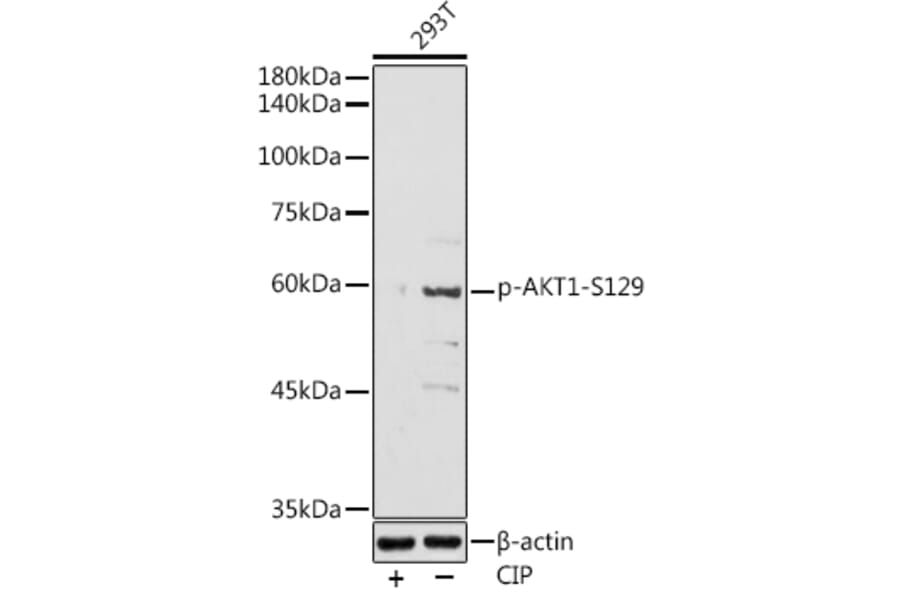 Western Blot - Anti-AKT1 (phospho Ser129) Antibody (A305611) - Antibodies.com