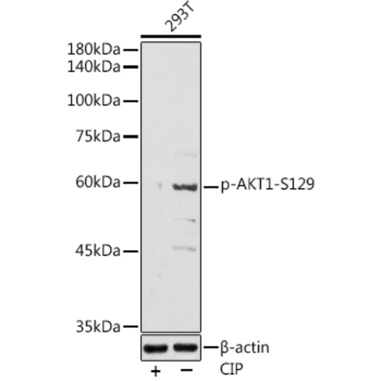 Western Blot - Anti-AKT1 (phospho Ser129) Antibody (A305611) - Antibodies.com