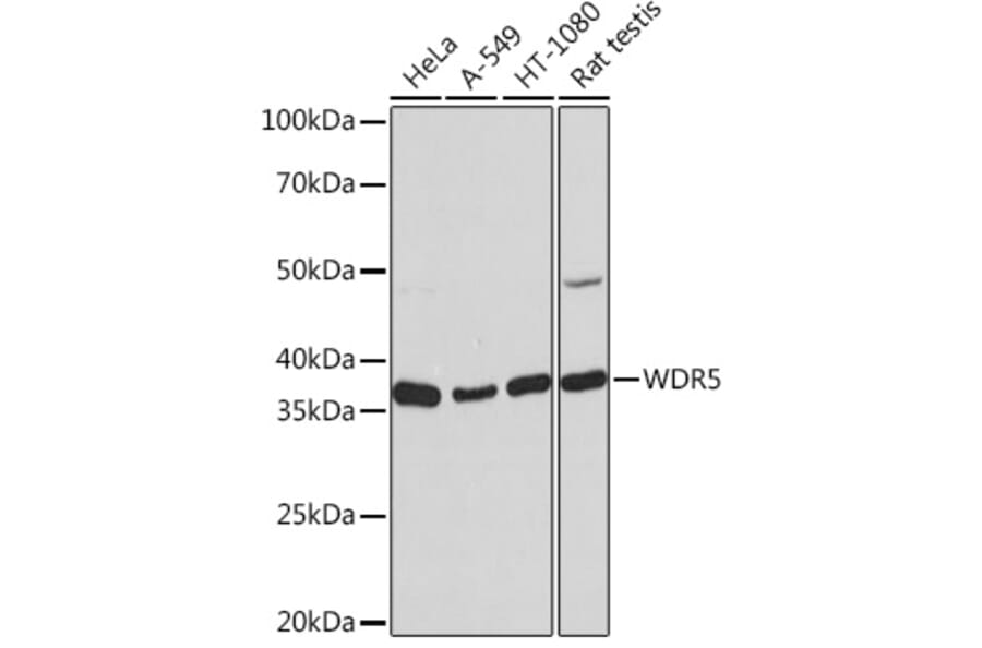 Western Blot - Anti-WDR5 Antibody [ARC0769] (A305612) - Antibodies.com