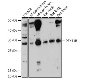 Western Blot - Anti-PEX11B Antibody (A305613) - Antibodies.com
