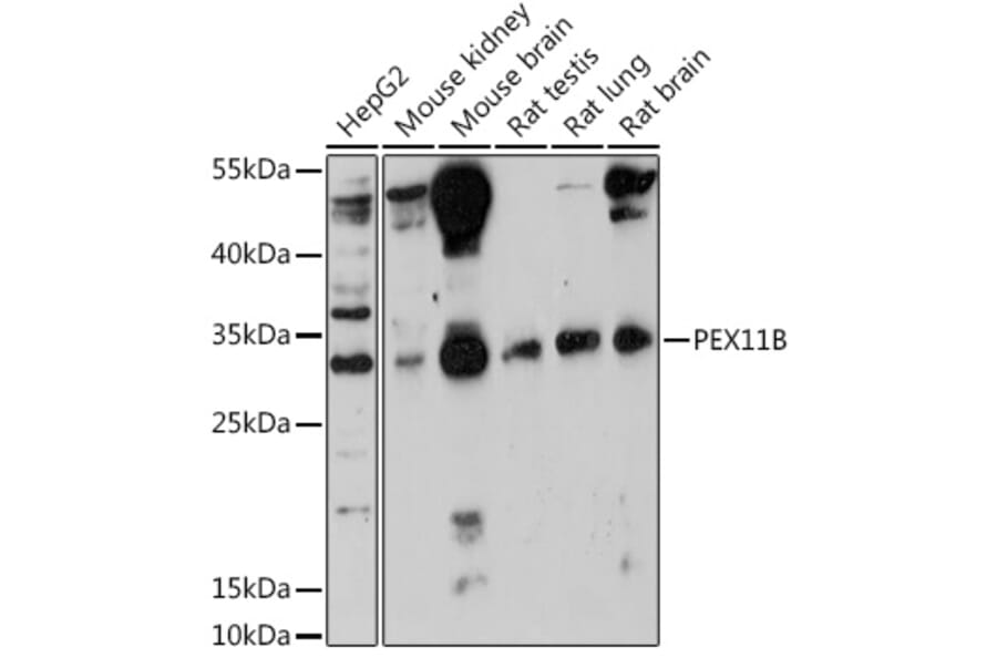 Western Blot - Anti-PEX11B Antibody (A305613) - Antibodies.com