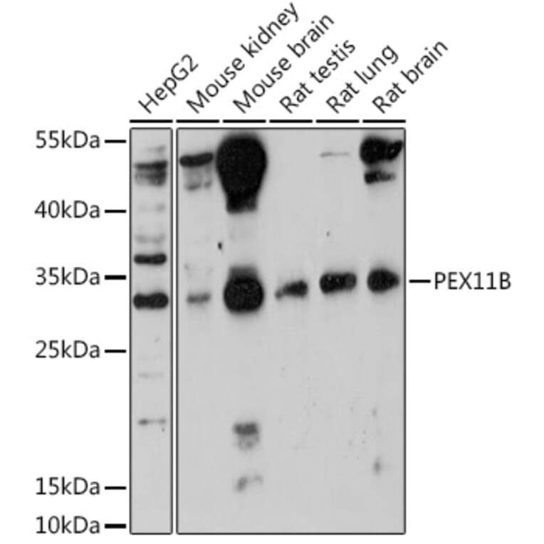 Western Blot - Anti-PEX11B Antibody (A305613) - Antibodies.com