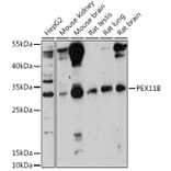 Western Blot - Anti-PEX11B Antibody (A305613) - Antibodies.com