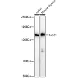 Western Blot - Anti-Rad21 Antibody (A305614) - Antibodies.com