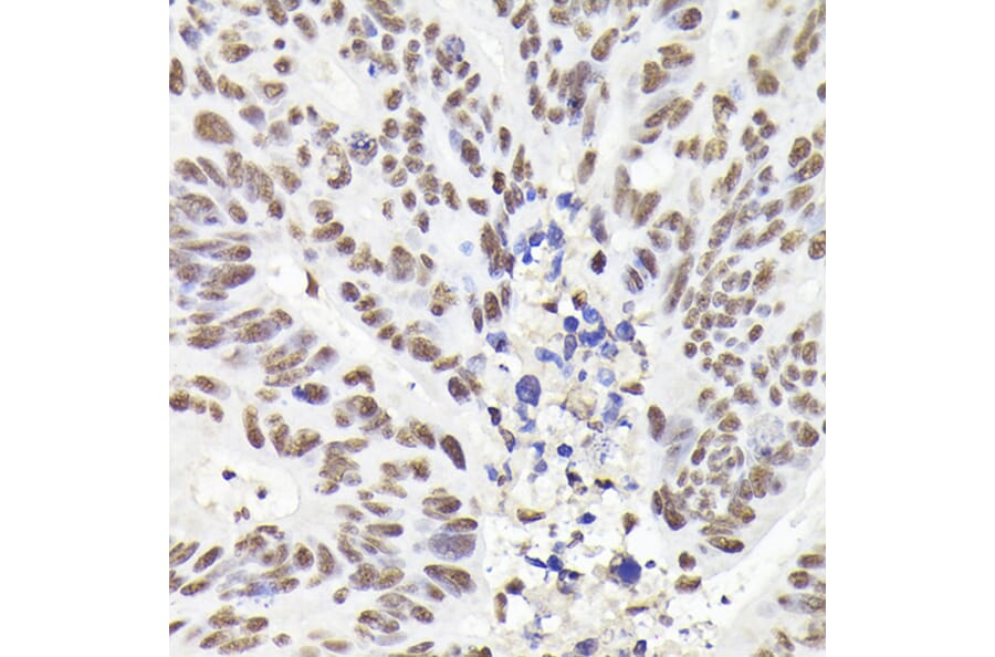 Immunohistochemistry - Anti-Rad21 Antibody (A305614) - Antibodies.com