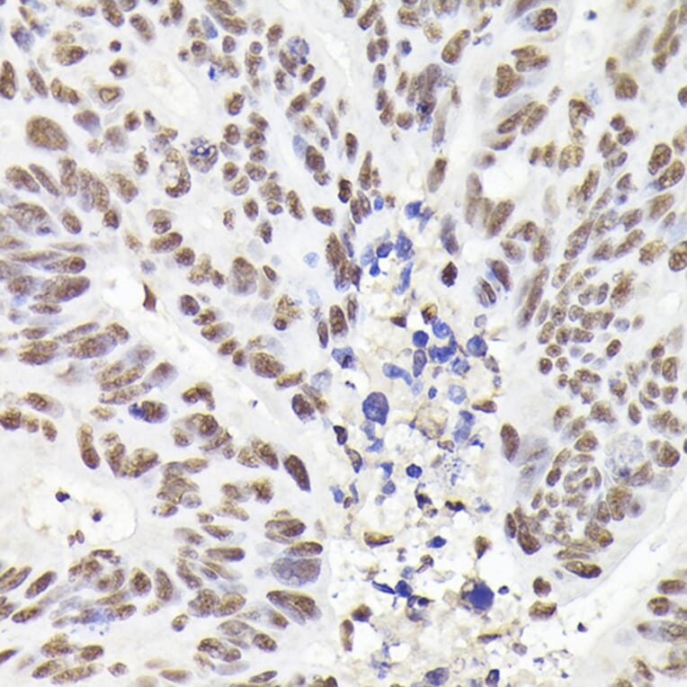 Immunohistochemistry - Anti-Rad21 Antibody (A305614) - Antibodies.com