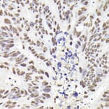 Immunohistochemistry - Anti-Rad21 Antibody (A305614) - Antibodies.com