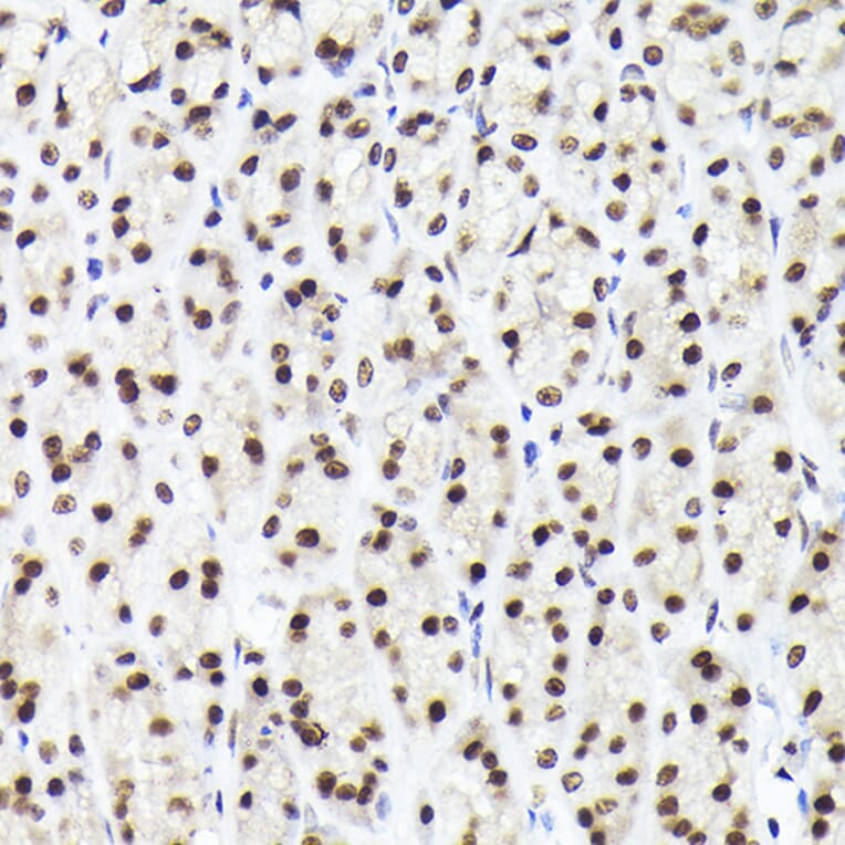 Immunohistochemistry - Anti-Rad21 Antibody (A305614) - Antibodies.com