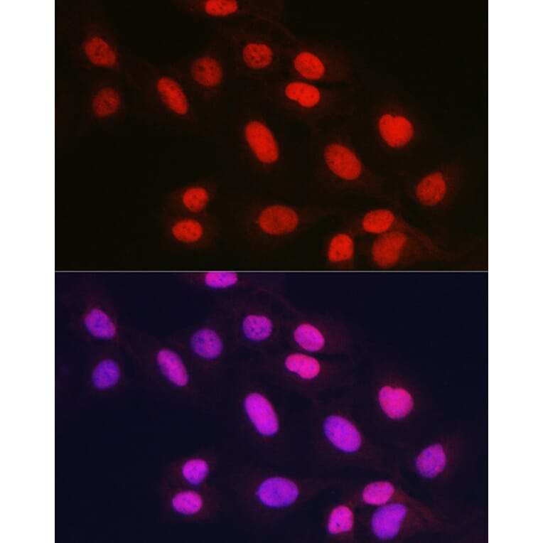 Immunofluorescence - Anti-Rad21 Antibody (A305614) - Antibodies.com