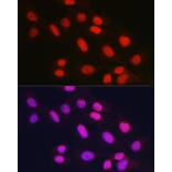 Immunofluorescence - Anti-Rad21 Antibody (A305614) - Antibodies.com
