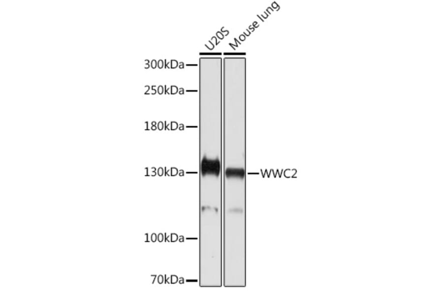 Western Blot - Anti-WWC2 Antibody (A305615) - Antibodies.com