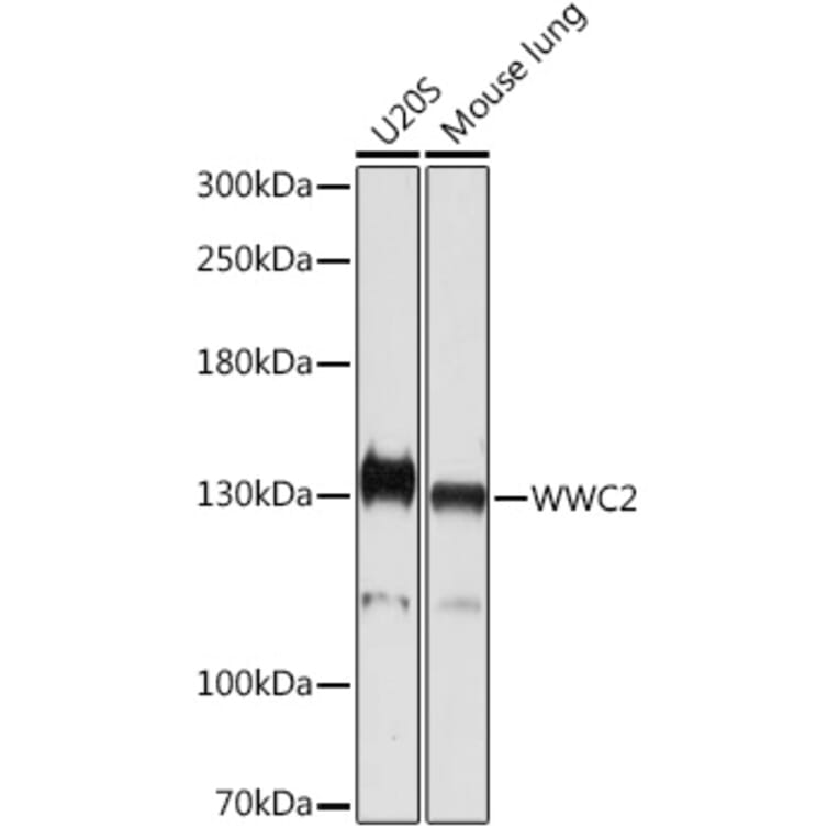Western Blot - Anti-WWC2 Antibody (A305615) - Antibodies.com