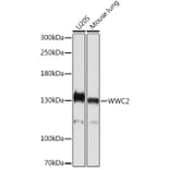 Western Blot - Anti-WWC2 Antibody (A305615) - Antibodies.com