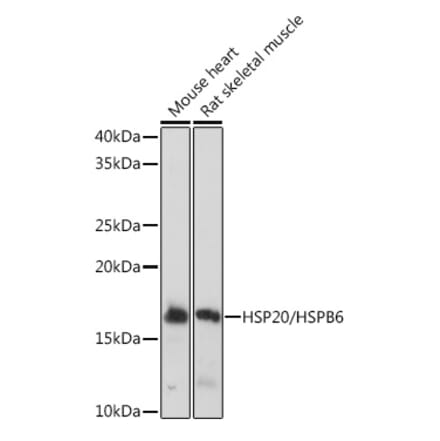 Western Blot - Anti-Hsp20 Antibody [ARC1787] (A305617) - Antibodies.com