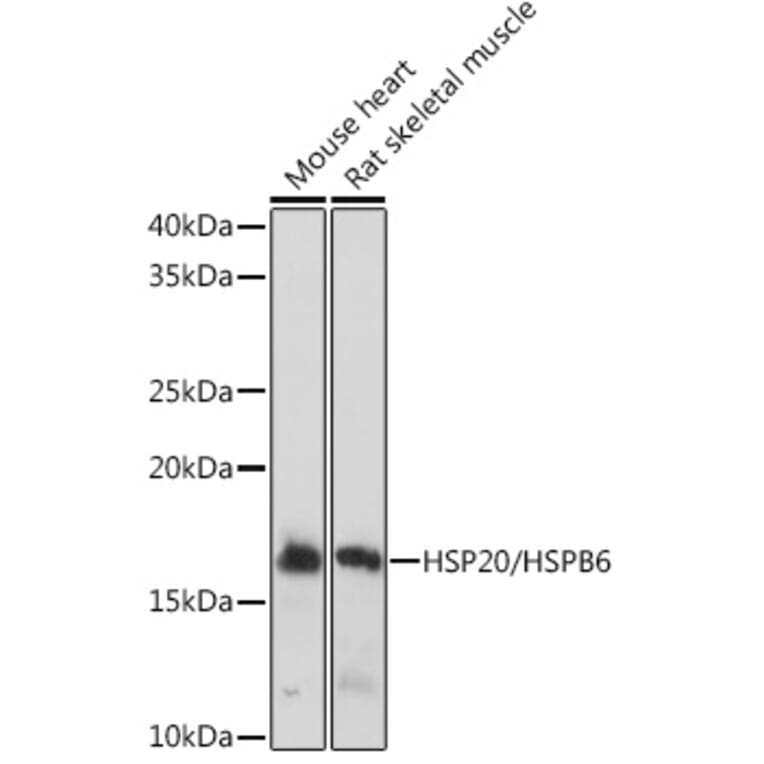 Western Blot - Anti-Hsp20 Antibody [ARC1787] (A305617) - Antibodies.com