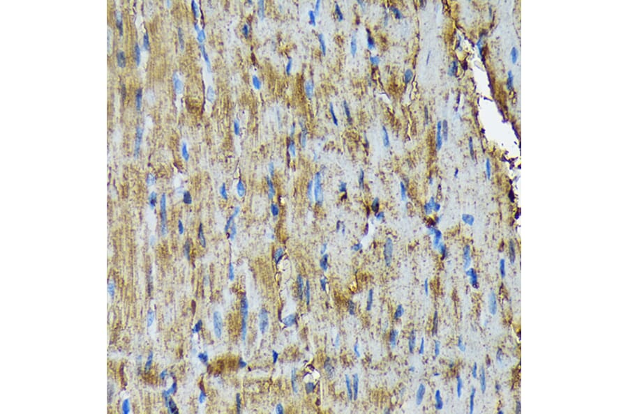 Immunohistochemistry - Anti-Hsp20 Antibody [ARC1787] (A305617) - Antibodies.com