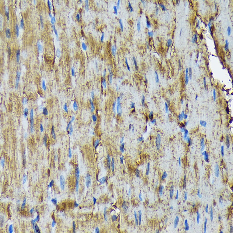 Immunohistochemistry - Anti-Hsp20 Antibody [ARC1787] (A305617) - Antibodies.com