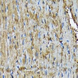 Immunohistochemistry - Anti-Hsp20 Antibody [ARC1787] (A305617) - Antibodies.com