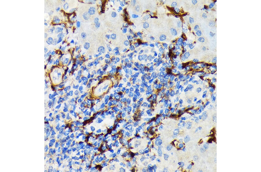 Immunohistochemistry - Anti-Hsp20 Antibody [ARC1787] (A305617) - Antibodies.com