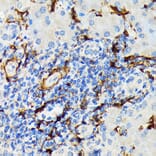 Immunohistochemistry - Anti-Hsp20 Antibody [ARC1787] (A305617) - Antibodies.com