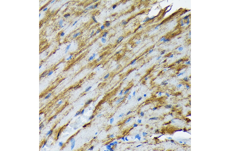 Immunohistochemistry - Anti-Hsp20 Antibody [ARC1787] (A305617) - Antibodies.com