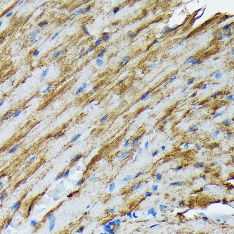 Immunohistochemistry - Anti-Hsp20 Antibody [ARC1787] (A305617) - Antibodies.com