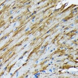 Immunohistochemistry - Anti-Hsp20 Antibody [ARC1787] (A305617) - Antibodies.com