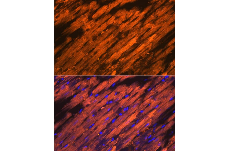 Immunofluorescence - Anti-Hsp20 Antibody [ARC1787] (A305617) - Antibodies.com