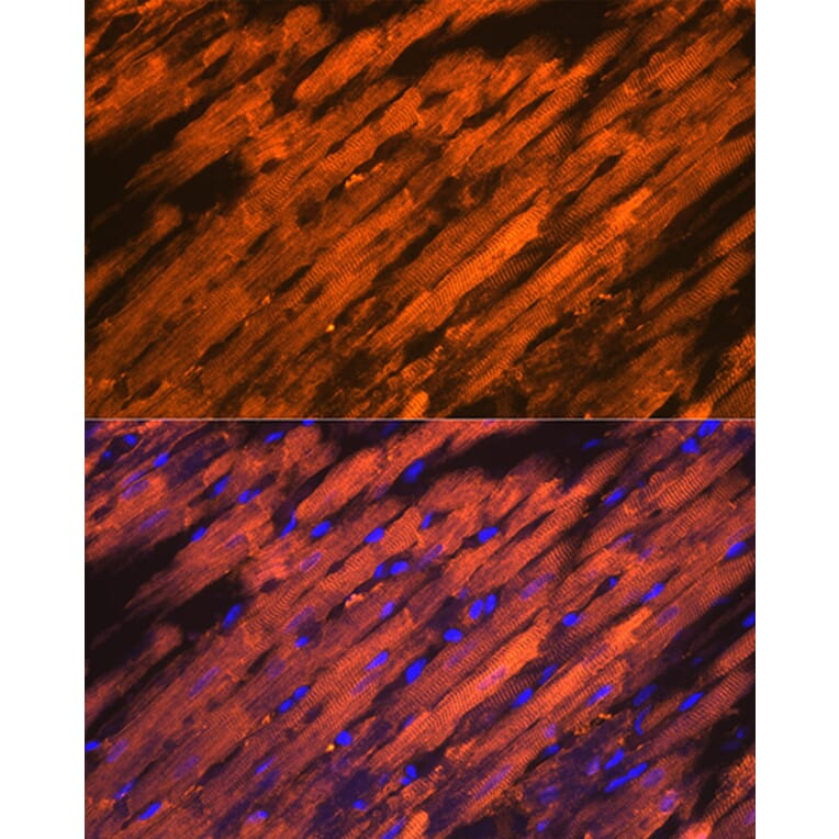 Immunofluorescence - Anti-Hsp20 Antibody [ARC1787] (A305617) - Antibodies.com