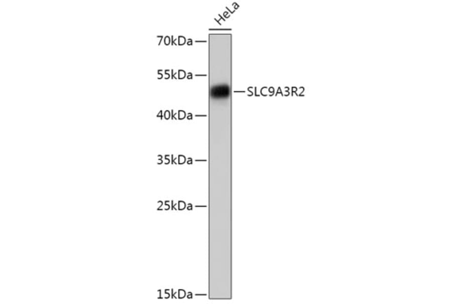 Western Blot - Anti-NHERF-2/SIP-1 Antibody (A305618) - Antibodies.com