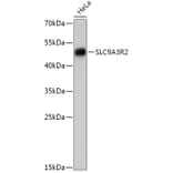 Western Blot - Anti-NHERF-2/SIP-1 Antibody (A305618) - Antibodies.com