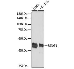 Western Blot - Anti-RING1 Antibody [ARC2278] (A305619) - Antibodies.com