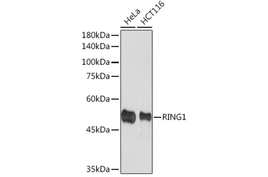 Western Blot - Anti-RING1 Antibody [ARC2278] (A305619) - Antibodies.com